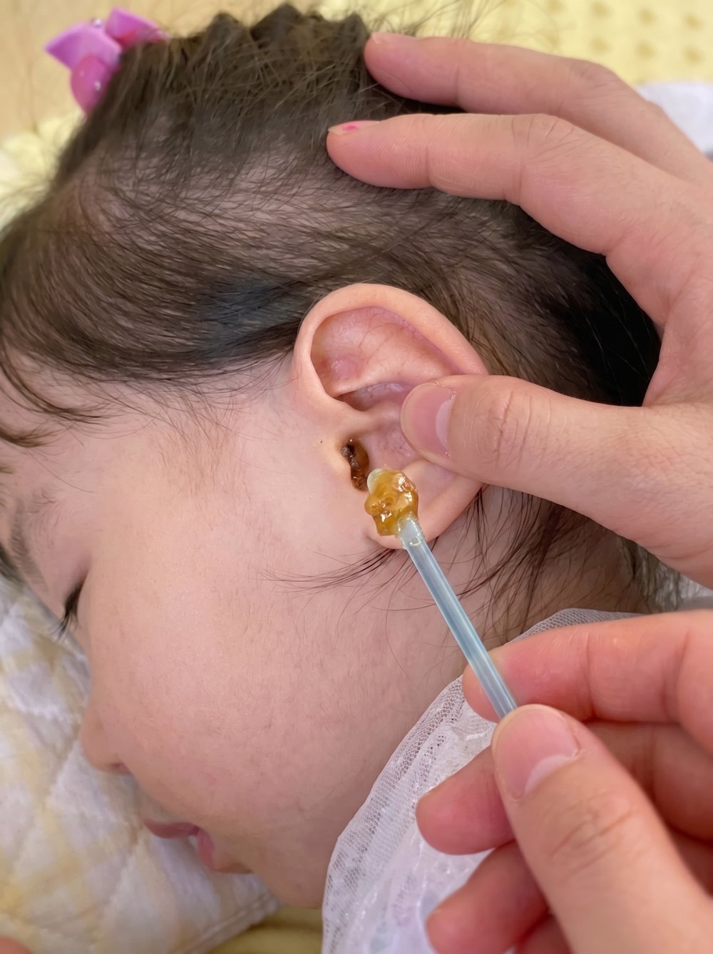 The EarClear tip after use — wax visibly lifted out